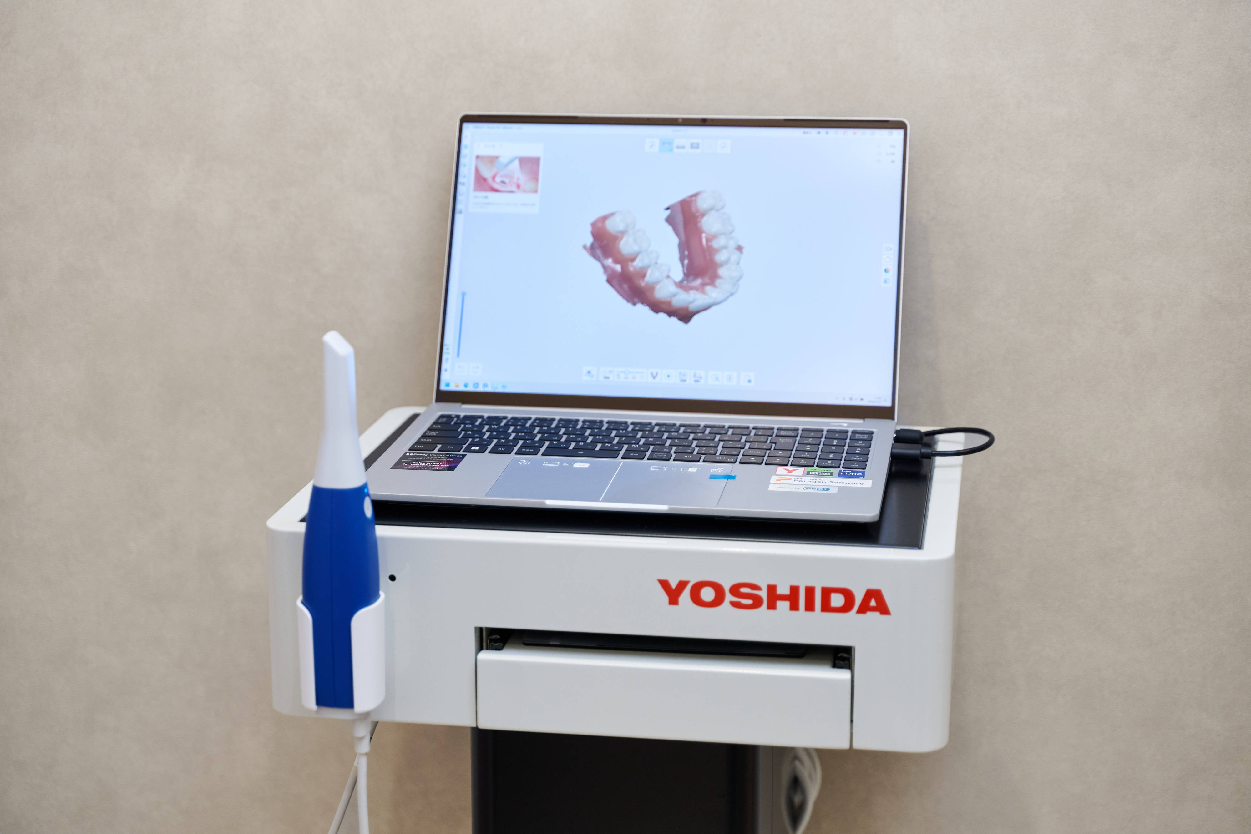 歯並びのシミュレーション画面と歯列模型